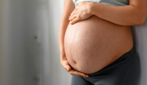 2 Schwangerschaftsstreifen entfernen schwangerschaft dehnungsstreifen frau bauch