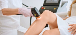 Bein lasern Laserhaarentfernung Behandlungsbilder 1