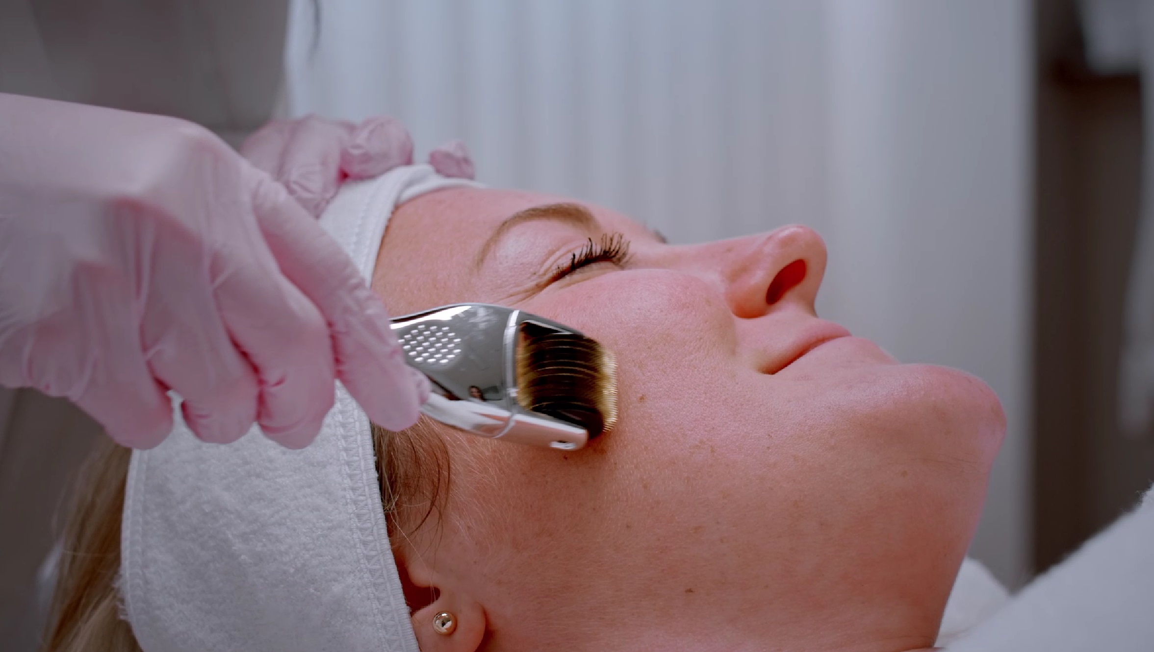 Dermaroller Microneedling Dermacare 1010 Wien