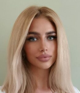 Edita Berisha 3 e1659703811138