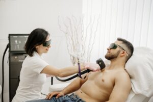 Hier sieht man schön die Laser Haarentfernung für Männer bei Dermacare Wien.