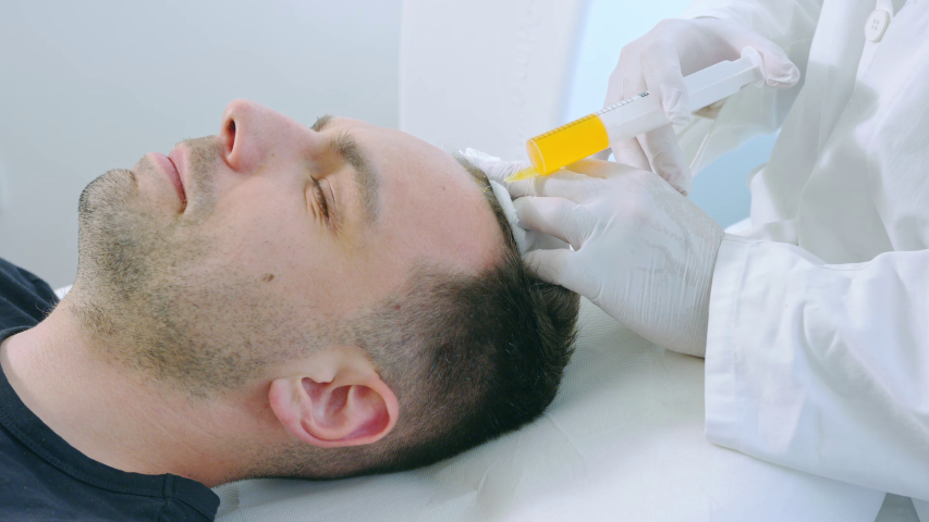 Klein Behandlung PRP gegen Haarausfall Dermacare 1010 Wien