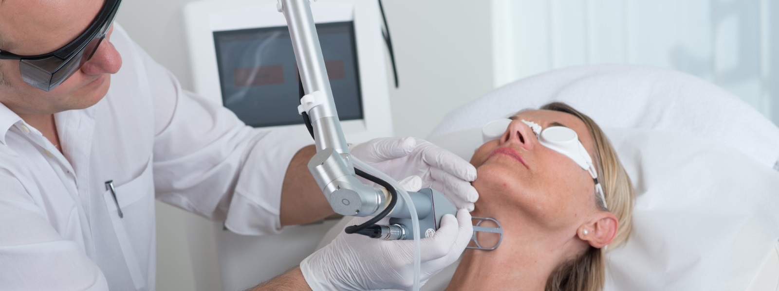 Pigmentflecken entfernen mit fraktioniertem CO2 Laser bei Dermacare 1010 Wien