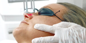 behandlung dermacare wien