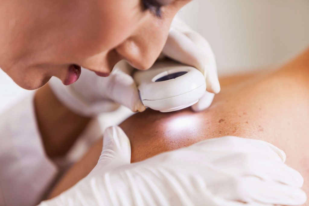 hautkrebsvorsorge muttermalkontrolle dermacare 1010 wien