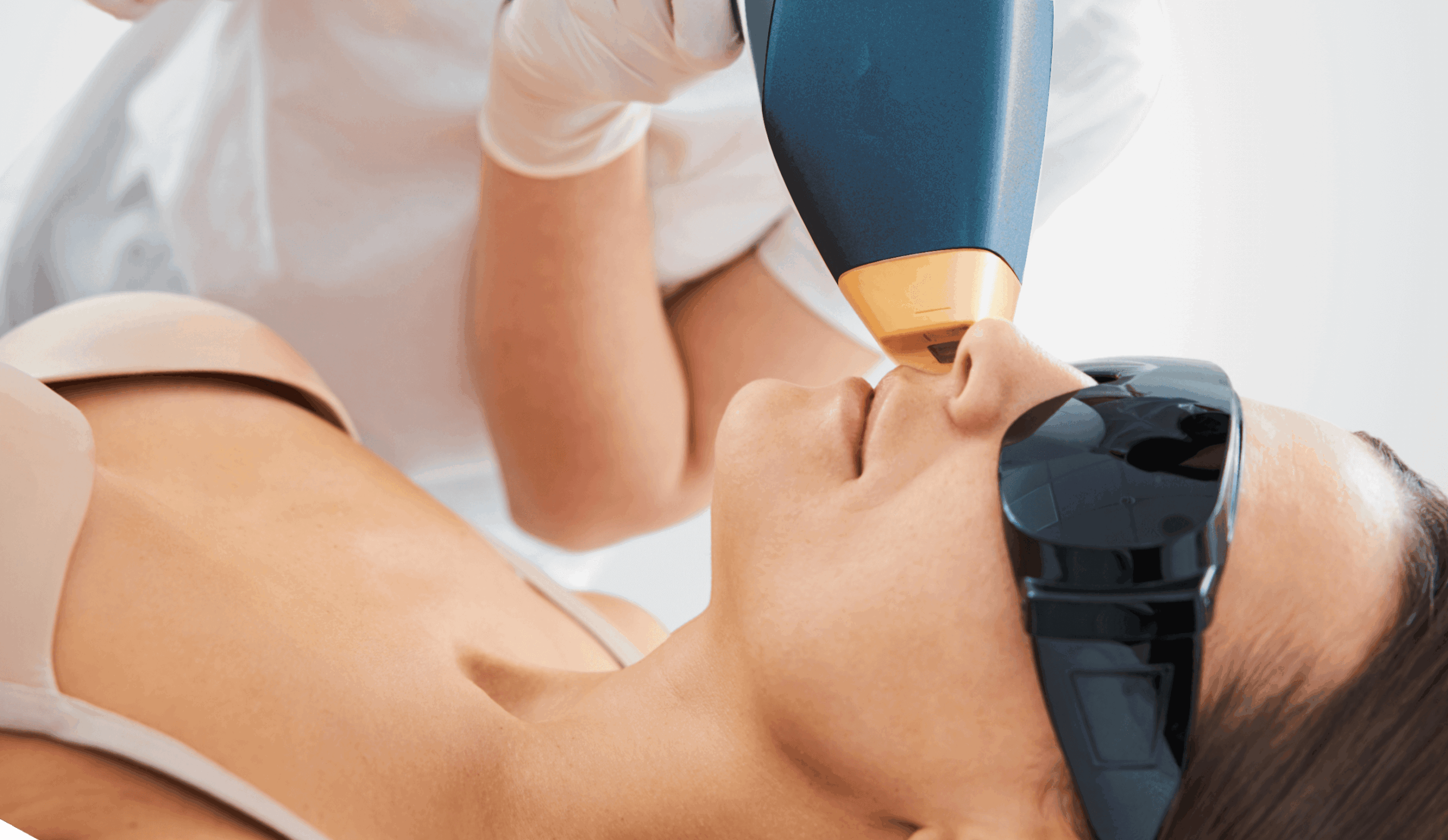 header Laserhaarentfernung oberlippe wien dermacare scaled