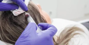 Hier sieht man wie Stammzellentherapie in Wien angewendet wird. Hautverjüngung und volleres haar bei Dermacare mit Miracell