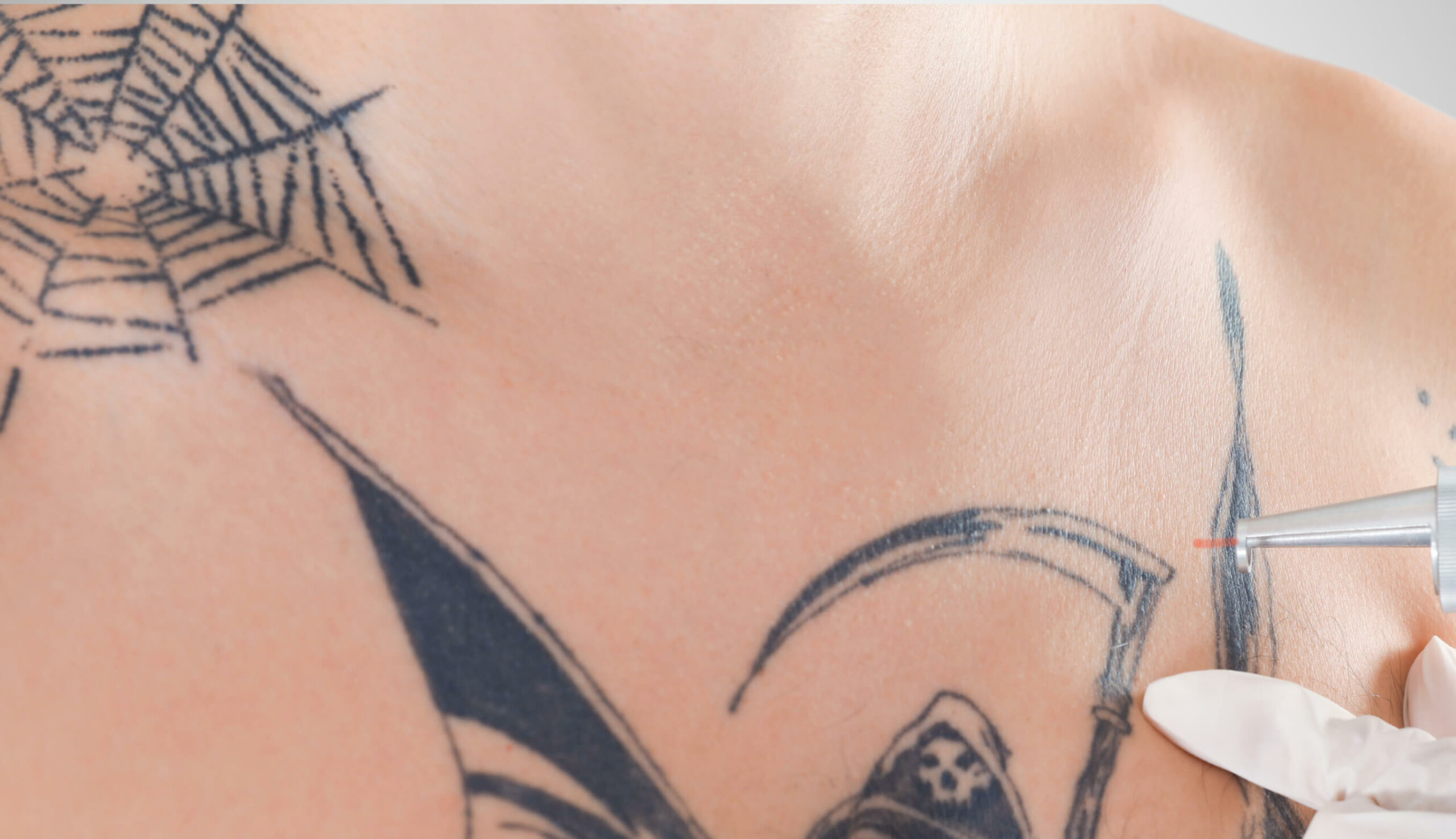 tattooentfernung tattoo schwarz tattoo aufhellen dermacare wien cover up scaled