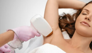 transgender Laserhaarentfernung wien Behandlungsbilder dermacare wien