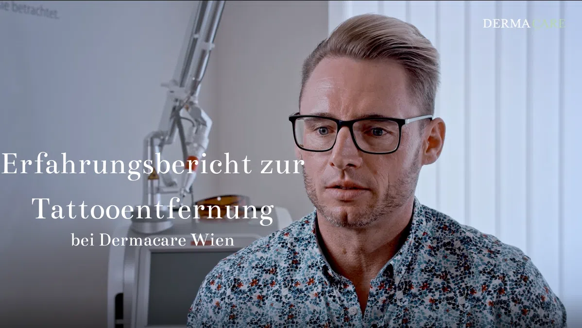 Erfahrungsbericht Tattooentfernung