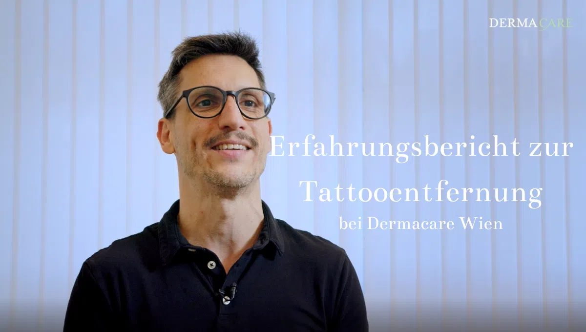 Erfahrungsbericht zur Tattooentfernung 1 1