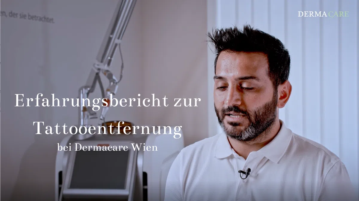 Erfahrungsbericht zur Tattooentfernung 1