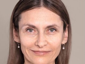 Faltenbehandlung mit Hyaluron in Wien bei Dermacare Vorher 867x650 1